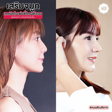 Slider image (9) The Art Clinic